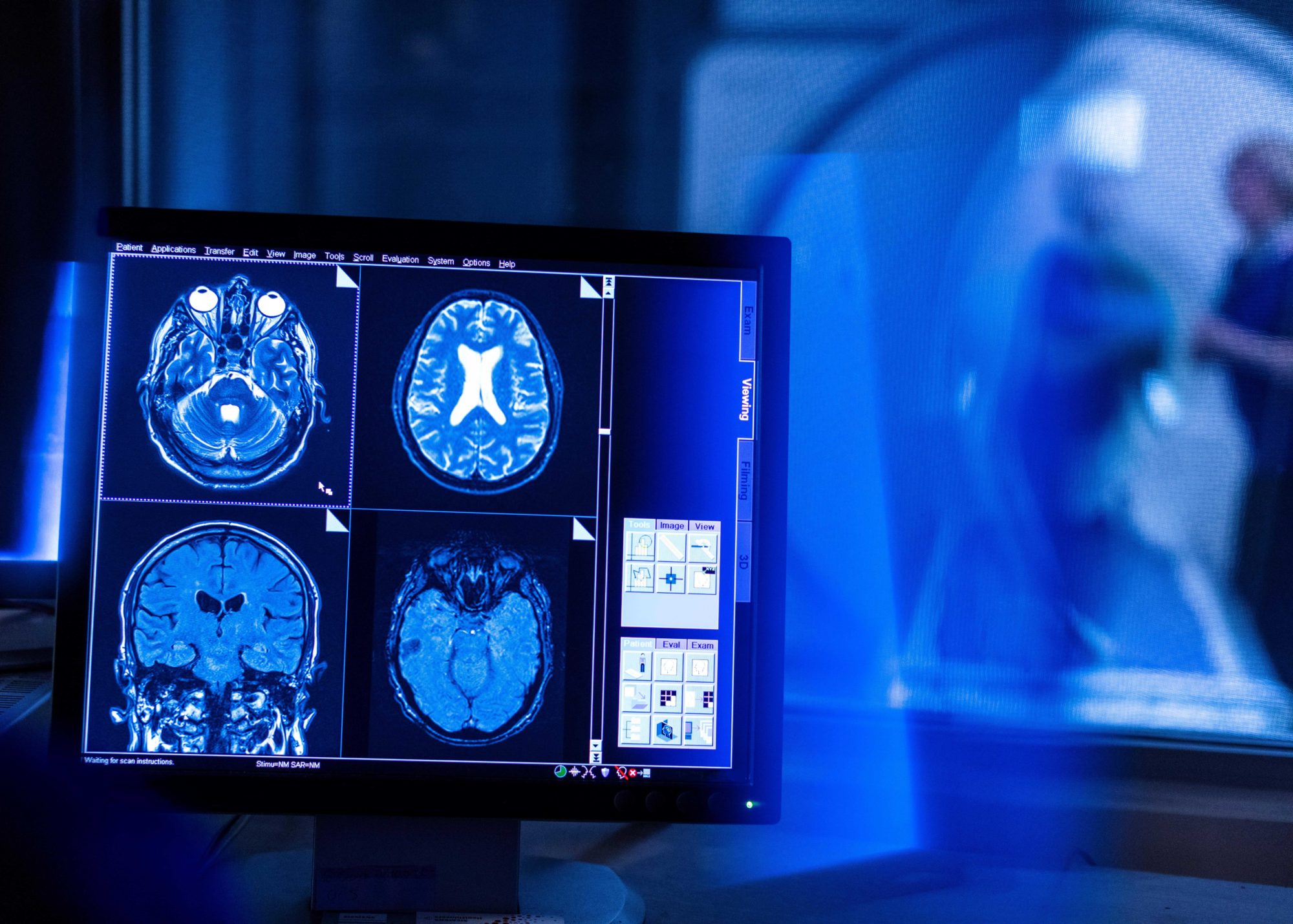 MRI Diagnosis